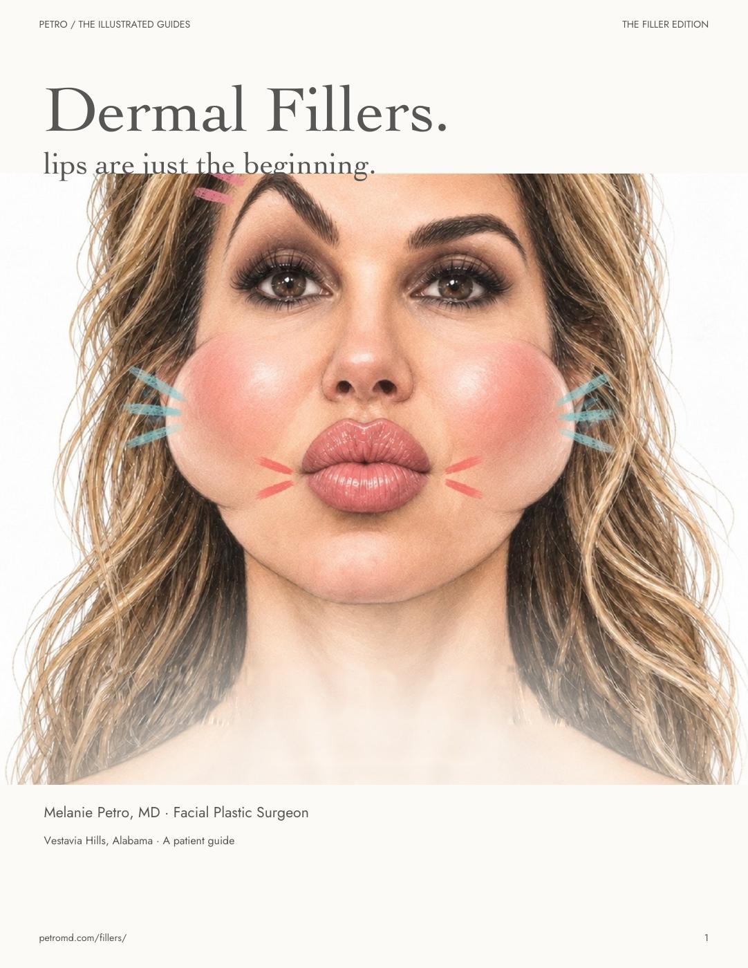 The illustrated dermal filler guide cover