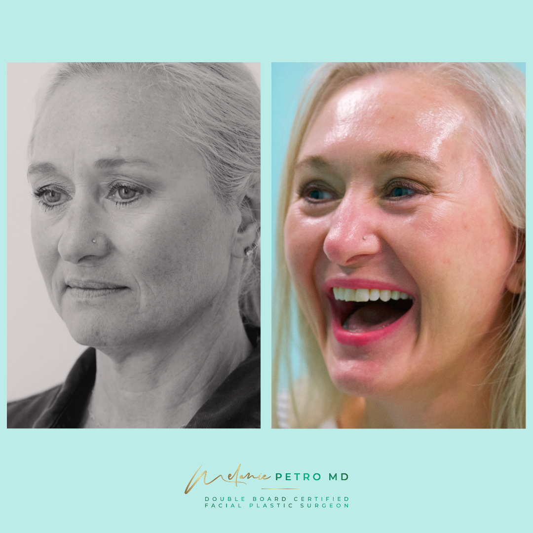Composite of two patient portraits, shown as supplied