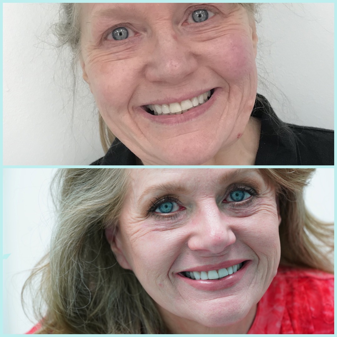 Two vertically stacked patient portraits, shown as supplied