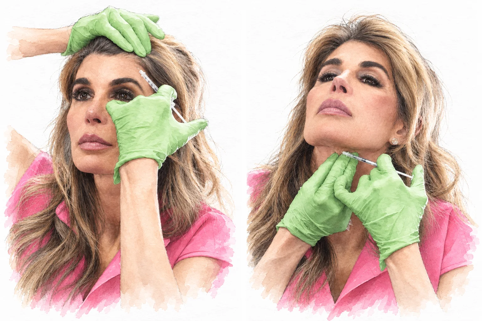 Two watercolor portraits of Dr. Melanie Petro during treatment moments involving the forehead and neck.
